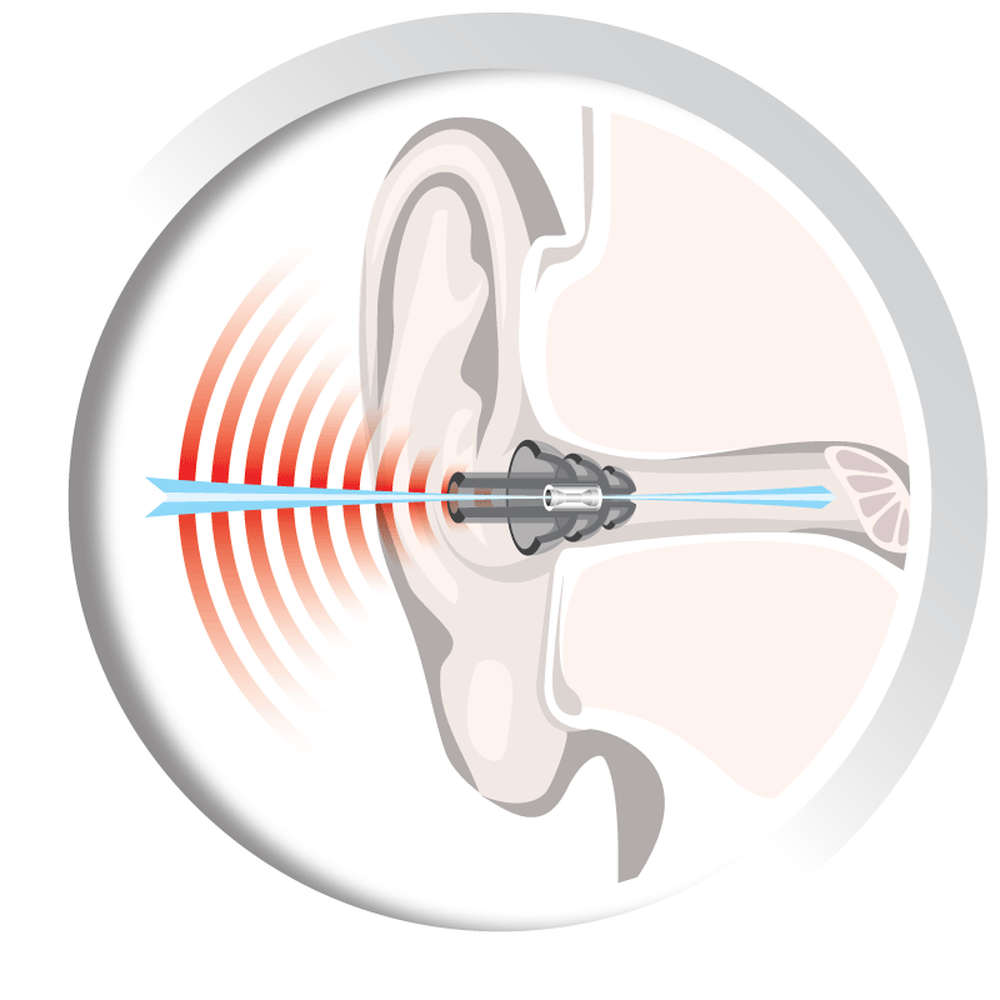 Auritech Hearing protectors-Gamefish